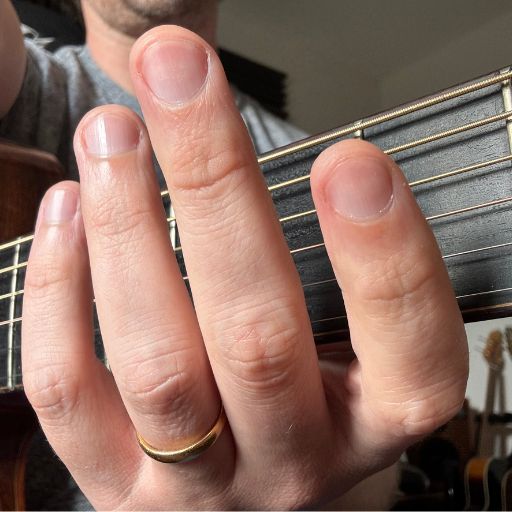 Guitar finger pain